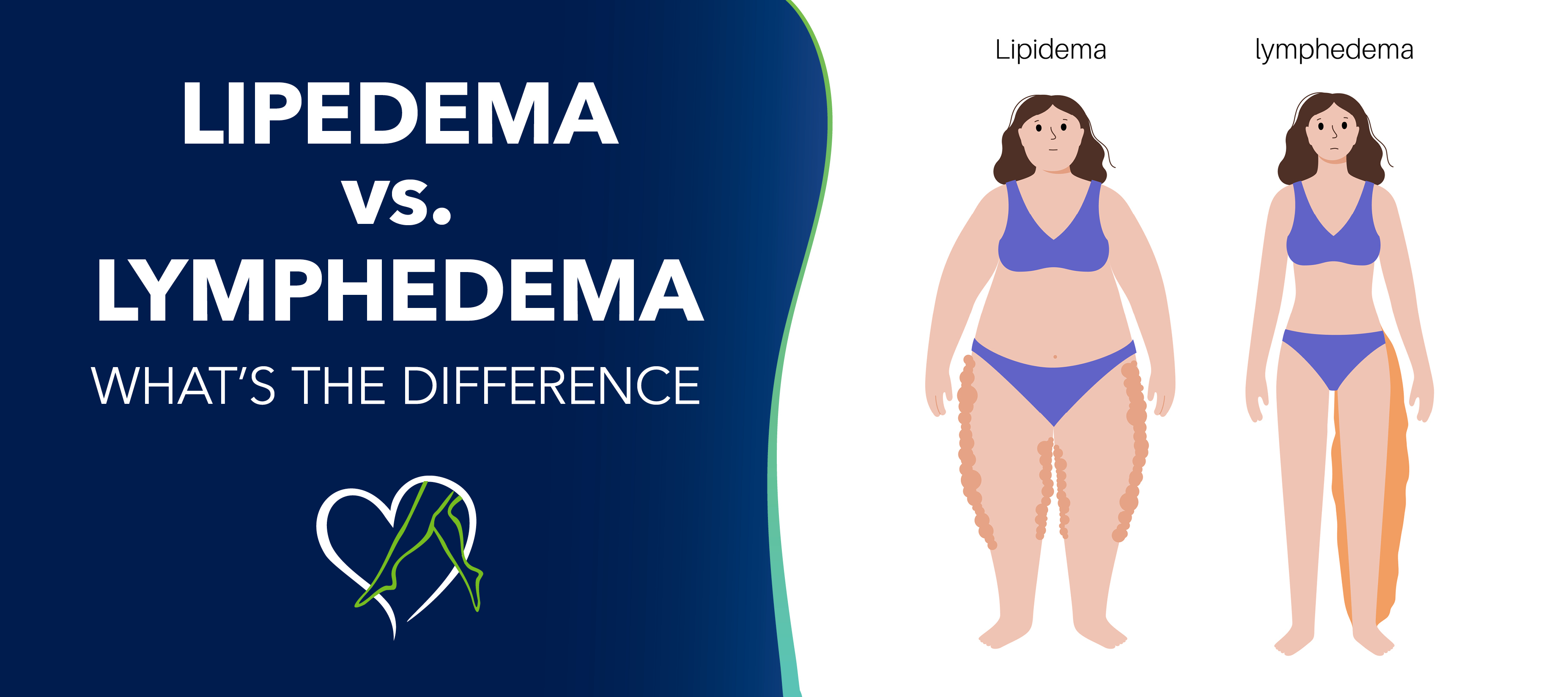 Understanding Lymphedema vs. Lipedema: The Role of Compression