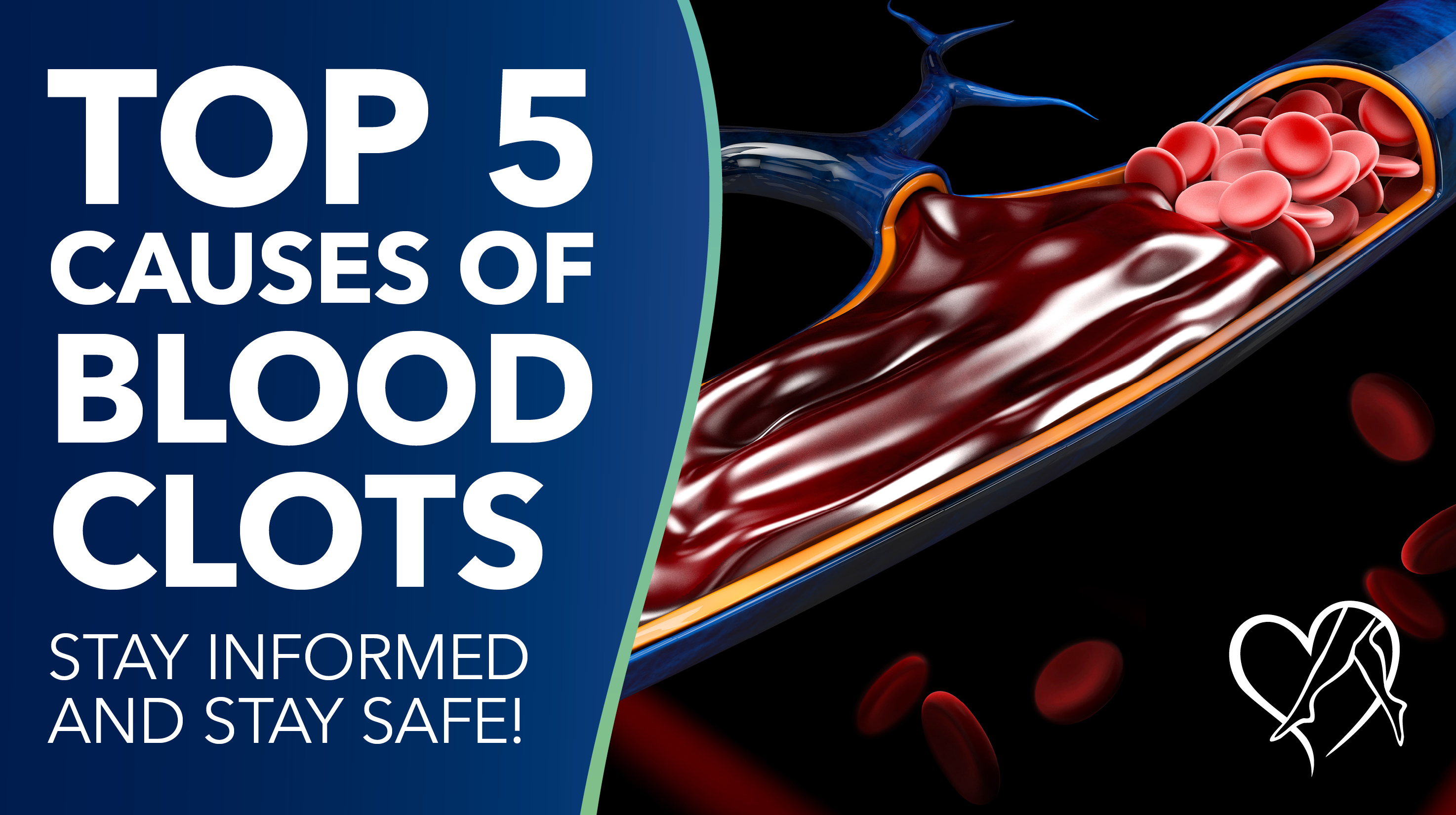 Learn About Blood Clots  Center for Vein Restoration