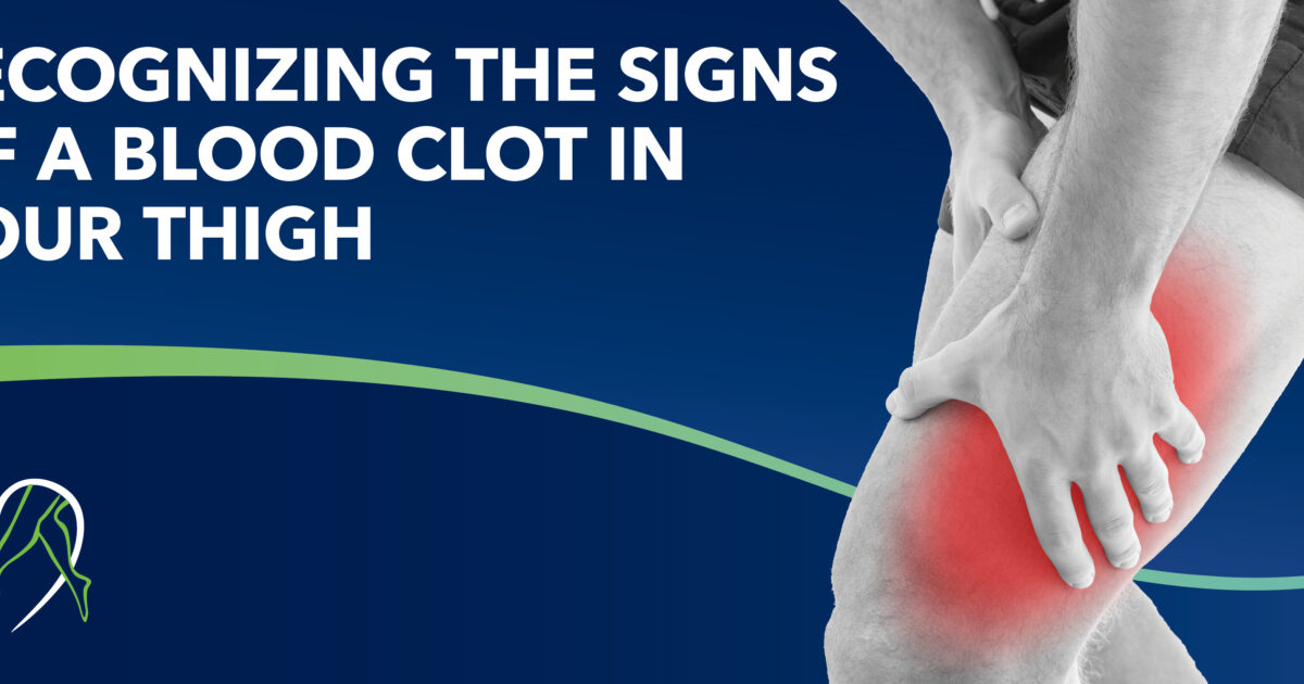 Recognizing the Signs of a Blood Clot in Your Thigh