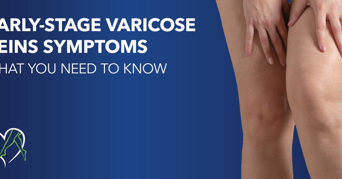 Early-Stage Varicose Veins Symptoms: What You Need to Know