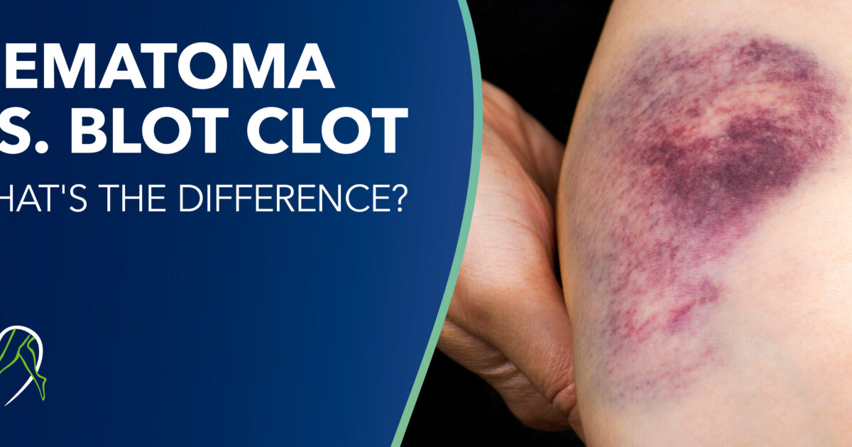 Difference Between Blood Clot and Tissue  Compare the Difference Between  Similar Terms