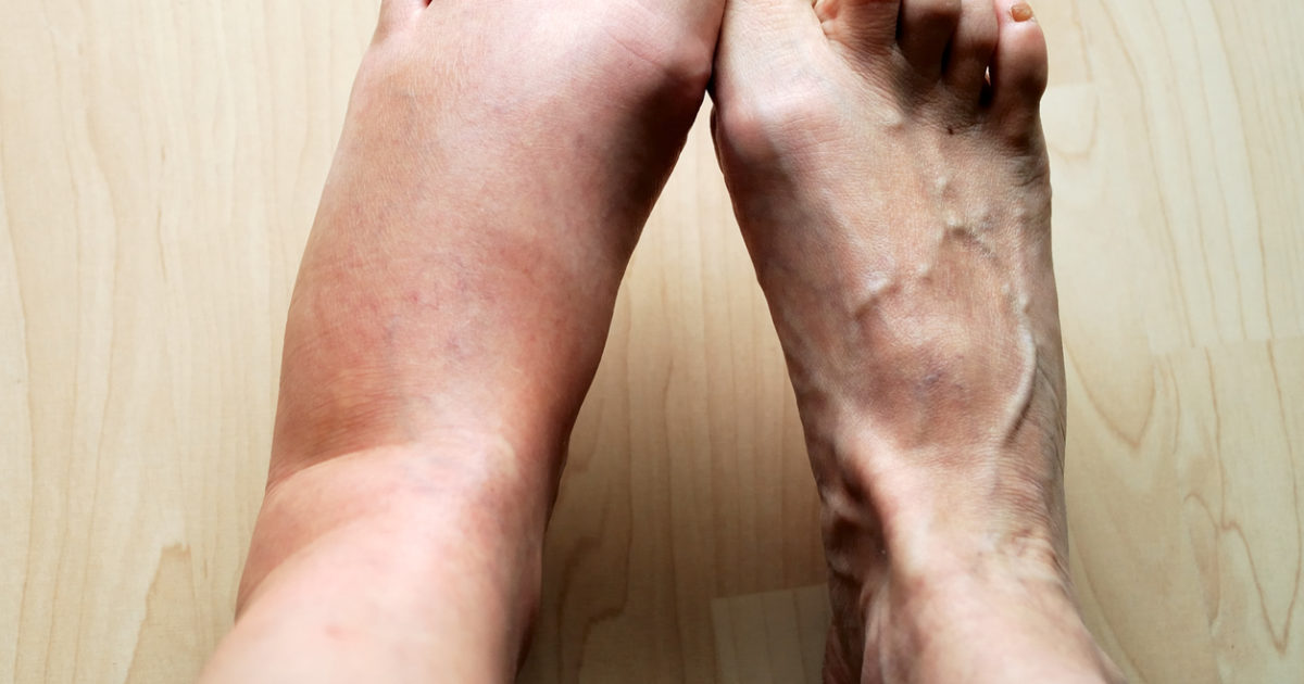 Know Your Feet And How To Take Care Of Them At 40 | Prevention